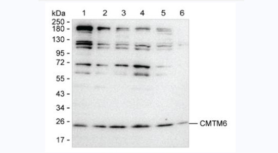 CMTM6 Antibody in Western Blot (WB)
