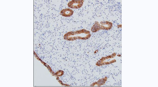 CMTM6 Antibody in Immunohistochemistry (Paraffin) (IHC (P))