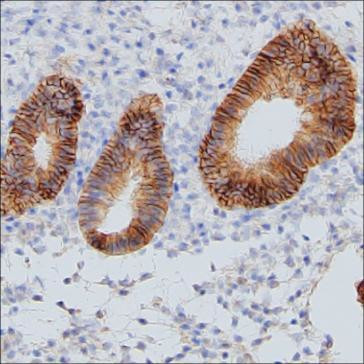 CMTM6 Antibody in Immunohistochemistry (Paraffin) (IHC (P))