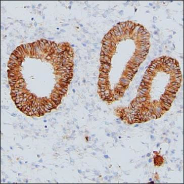 CMTM6 Antibody in Immunohistochemistry (Paraffin) (IHC (P))