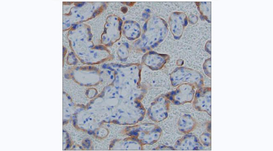 hCG beta Antibody in Immunohistochemistry (Paraffin) (IHC (P))