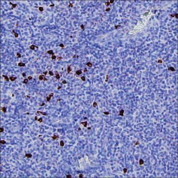 Human IgG4 Antibody in Immunohistochemistry (Paraffin) (IHC (P))