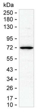 CTCFL Antibody in Western Blot (WB)
