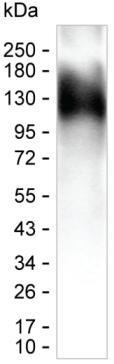 TEV Tag Antibody in Western Blot (WB)