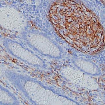 FCAMR Antibody in Immunohistochemistry (Paraffin) (IHC (P))