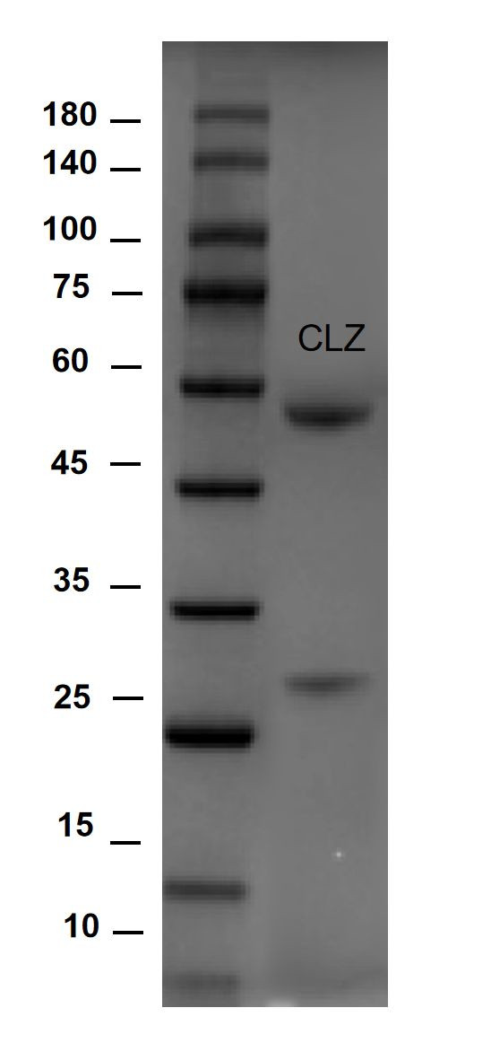 Carazolol Antibody in SDS-PAGE (SDS-PAGE)