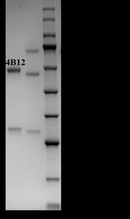 Digitoxin Antibody in SDS-PAGE (SDS-PAGE)