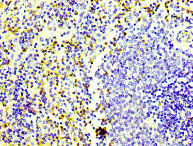 CD163 Antibody in Immunohistochemistry (Paraffin) (IHC (P))