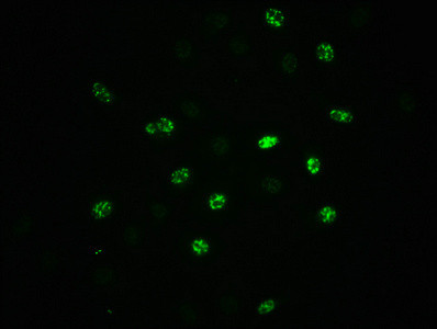 Phospho-EIF2S1 (Ser51) Antibody in Immunocytochemistry (ICC/IF)