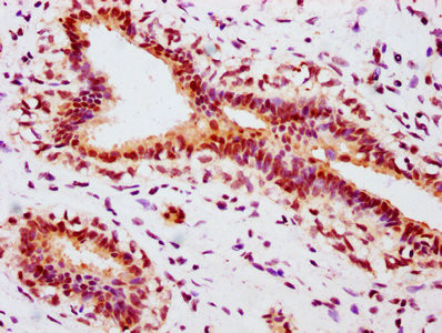 Phospho-Estrogen Receptor alpha (Ser118) Antibody in Immunohistochemistry (Paraffin) (IHC (P))
