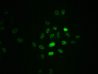 Phospho-RPA2 (Thr21) Antibody in Immunocytochemistry (ICC/IF)