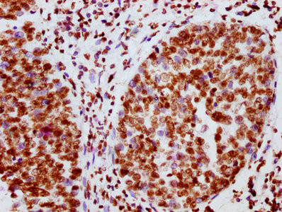 Phospho-JAK2 (Tyr1007, Tyr1008) Antibody in Immunohistochemistry (Paraffin) (IHC (P))