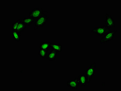 Phospho-c-Raf (Ser43) Antibody in Immunocytochemistry (ICC/IF)