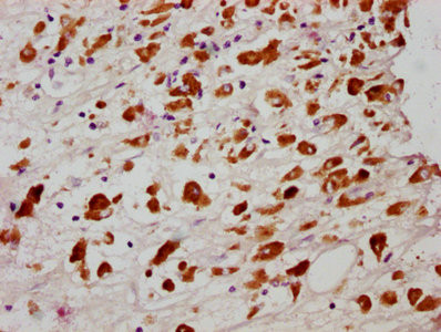 Phospho-MLKL (Ser358) Antibody in Immunohistochemistry (Paraffin) (IHC (P))