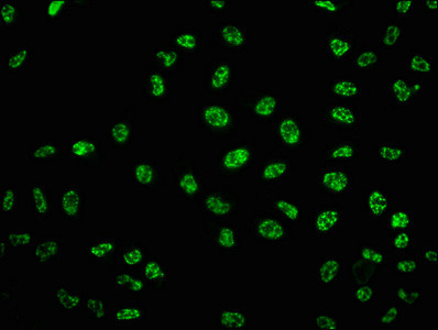 Phospho-p53 (Ser33) Antibody in Immunocytochemistry (ICC/IF)