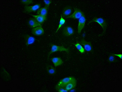 Phospho-p53 (Ser9) Antibody in Immunocytochemistry (ICC/IF)