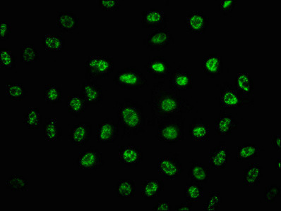 Phospho-DNA-PK (Ser2056) Antibody in Immunocytochemistry (ICC/IF)