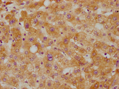 CETP Antibody in Immunohistochemistry (Paraffin) (IHC (P))