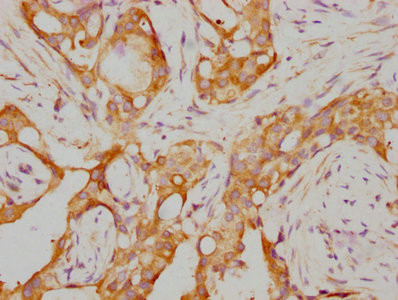 RARA Antibody in Immunohistochemistry (Paraffin) (IHC (P))
