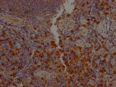 CD8a Antibody in Immunohistochemistry (Paraffin) (IHC (P))