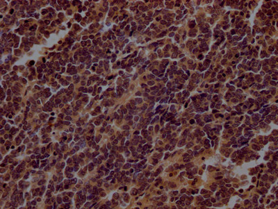 TERT Antibody in Immunohistochemistry (Paraffin) (IHC (P))