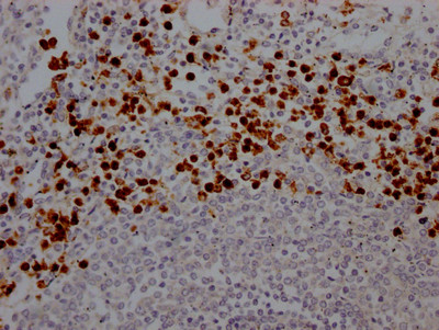 Myeloperoxidase Antibody in Immunohistochemistry (Paraffin) (IHC (P))