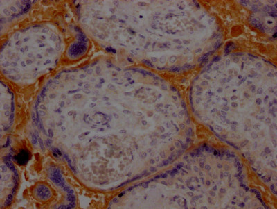 Haptoglobin Antibody in Immunohistochemistry (Paraffin) (IHC (P))