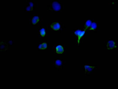 Tyrosinase Antibody in Immunocytochemistry (ICC/IF)