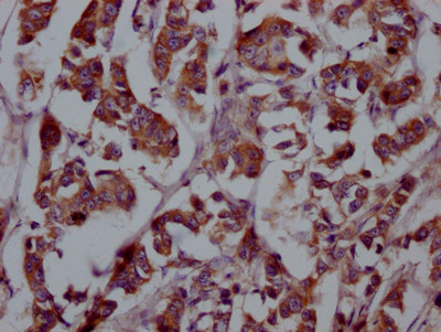 FGFR4 Antibody in Immunohistochemistry (Paraffin) (IHC (P))