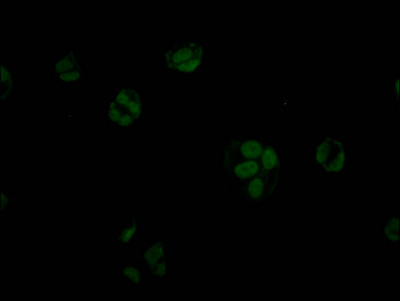 STAG2 Antibody in Immunocytochemistry (ICC/IF)