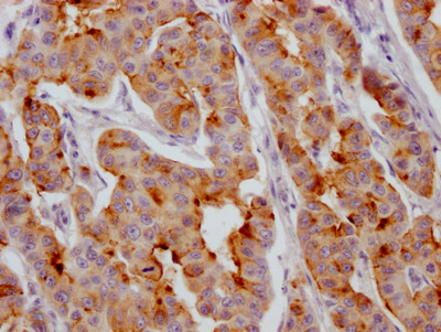 IGFBP2 Antibody in Immunohistochemistry (Paraffin) (IHC (P))