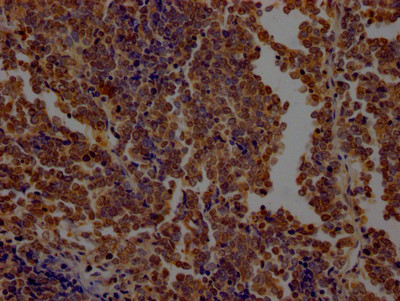 OGT Antibody in Immunohistochemistry (Paraffin) (IHC (P))