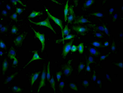 JAK2 Antibody in Immunocytochemistry (ICC/IF)