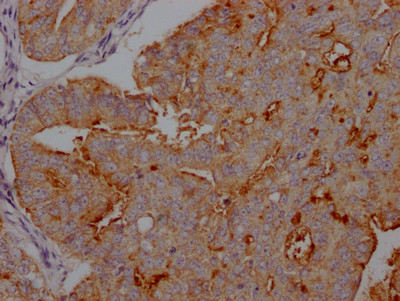 CA125 Antibody in Immunohistochemistry (Paraffin) (IHC (P))