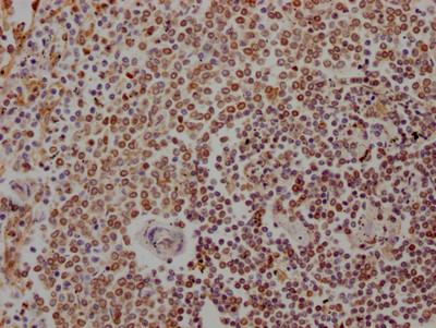 ALOX5 Antibody in Immunohistochemistry (Paraffin) (IHC (P))