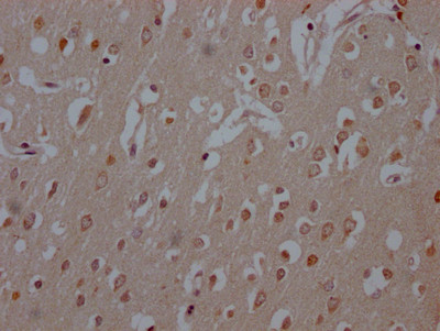 COMT Antibody in Immunohistochemistry (Paraffin) (IHC (P))