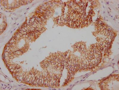 SNAP23 Antibody in Immunohistochemistry (Paraffin) (IHC (P))