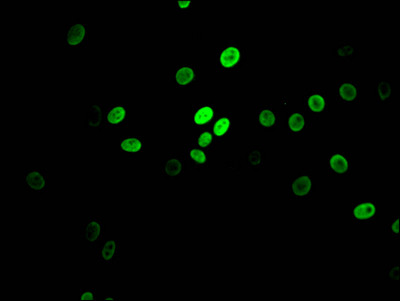 MYBBP1A Antibody in Immunocytochemistry (ICC/IF)
