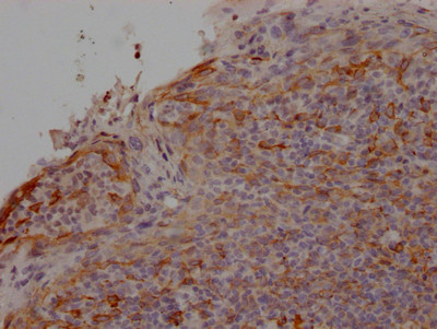 CCR2 Antibody in Immunohistochemistry (Paraffin) (IHC (P))