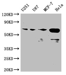 MST2 Antibody in Western Blot (WB)