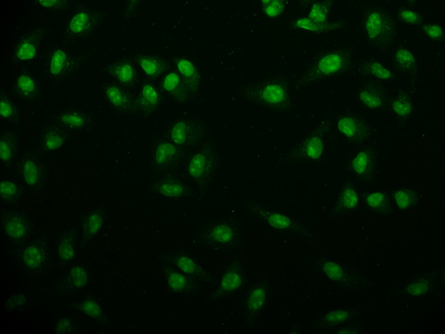 USP22 Antibody in Immunocytochemistry (ICC/IF)