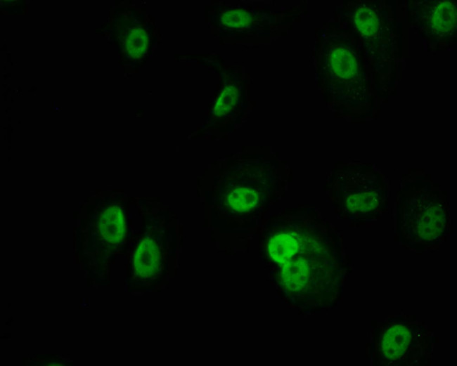 PKN2 Antibody in Immunocytochemistry (ICC/IF)