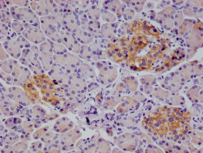 CD166 Antibody in Immunohistochemistry (Paraffin) (IHC (P))