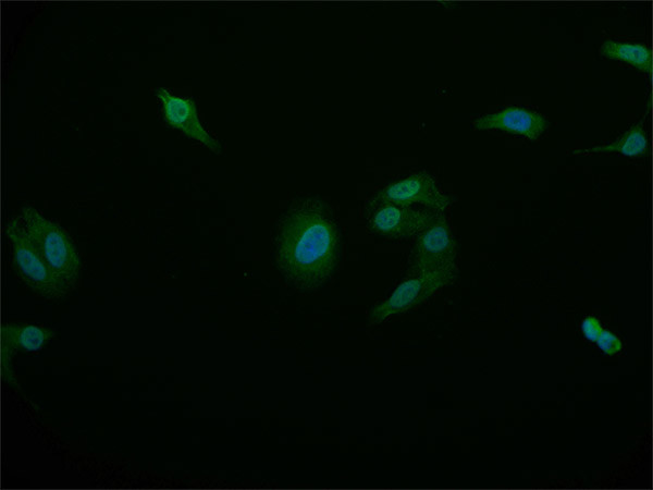 STAT4 Antibody in Immunocytochemistry (ICC/IF)