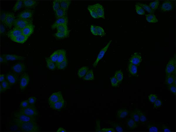 USP14 Antibody in Immunocytochemistry (ICC/IF)
