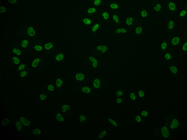 CDX1 Antibody in Immunocytochemistry (ICC/IF)