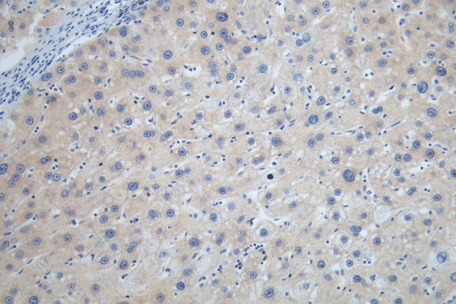 STK33 Antibody in Immunohistochemistry (Paraffin) (IHC (P))