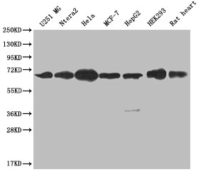 CBX2 Antibody in Western Blot (WB)