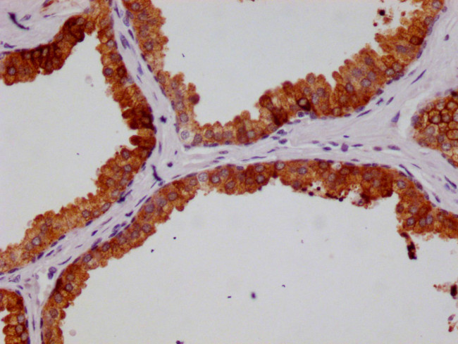 HGD Antibody in Immunohistochemistry (Paraffin) (IHC (P))