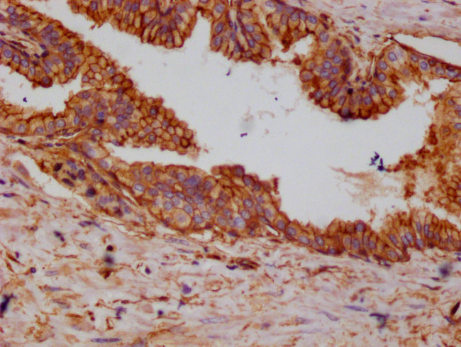Annexin A2 Antibody in Immunohistochemistry (Paraffin) (IHC (P))